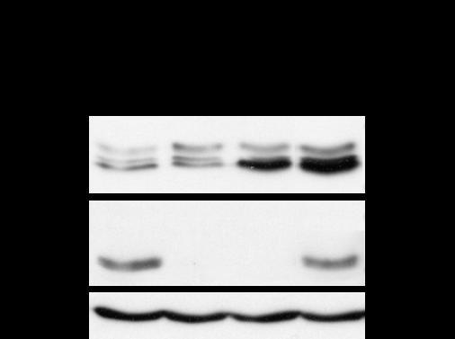 Rysunek 12 - Oznaczenie poziomu ekspresji czynników transkrypcyjnych Sox2 i Nanog metodą Western blot.