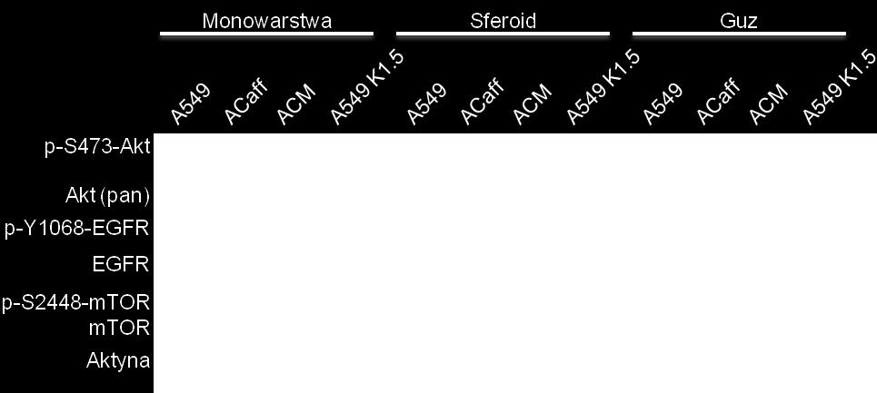 Informacje te oraz badania prowadzone w naszej grupie badawczej pokazują wpływ kofeiny na szlak PI3K/Akt/mTOR.