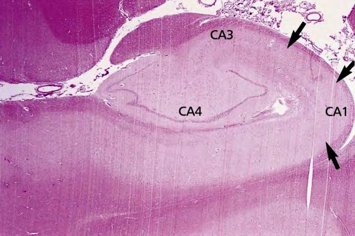 Aksony strony komórek z pola CA3 (tzw. kolaterale rozgałęzienia mózgu pochodzące Schaffera) aksonów z włókien neuronów komisuralnych docierają do CA1 CA3).