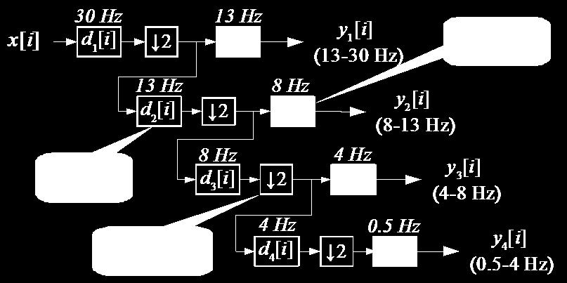 The medical diagnosis in most cases is based on the analysis of the wave shape [1], so filtering have to be done carefully to not introduce any significant distortions to the shape of the signal.