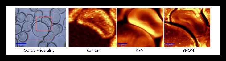 Zespół Obrazowania Ramanowskiego prof. dr hab. M.