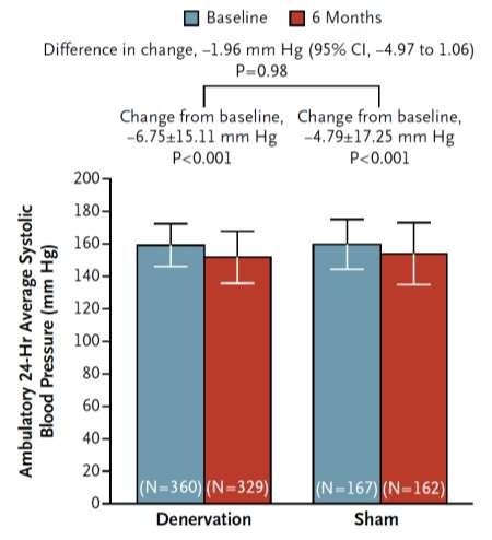 A Controlled Trial of Renal Denervation for