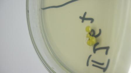 Wankomycyna 30 µg (VA 30). Następnie oceniono wrażliwości bakterii pochodzących z inicjalnych lub ustabilizowanych kultur jagody kamczackiej.