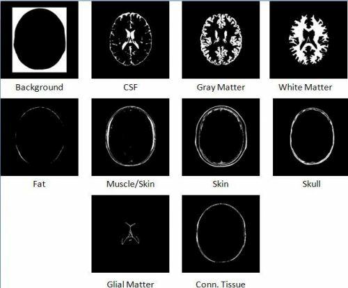 Magnetic Resonance Images January 30,