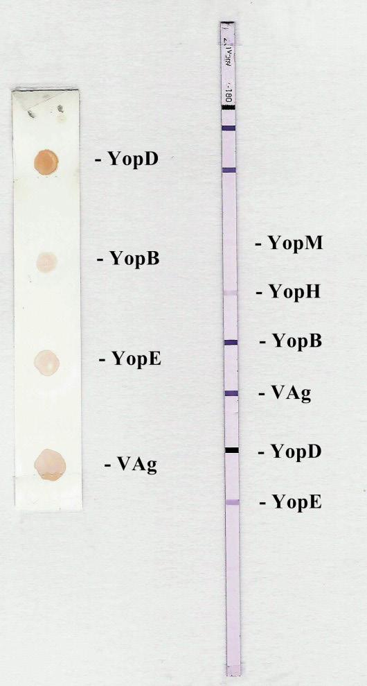 Nr 1 Przydatność białek Yop w serodiagnostyce jersiniozy 29 Przeciwciała klasy IgG dla białka V-Ag stwierdzano w 32,4%, dla białka YopB w 27,0% i dla białka YopE w 18,9%.