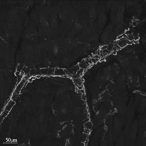 ciałka neuroepitelialne (NEBs) w