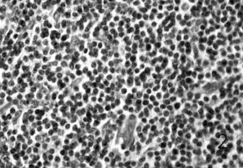 Proliferacja limfocytów T C 4.