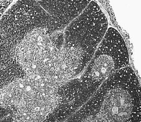 Dojrzewanie limfocytów w grasicy komórka gwiaździsta prezentująca MHC 3.
