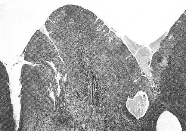 wpukleń nabłonka nabłonek dróg oddechowych PODSTAWY IMMUNOHISTOCHEMII Determinanty antygenowe (epitopy) - fragmenty