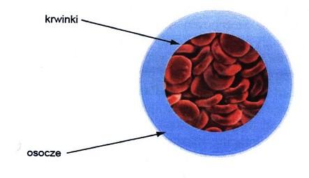 Hemoreologia Krew jest płynem nienewtonowskim rozrzedzonym ścinaniem- pseudoplastycznym i