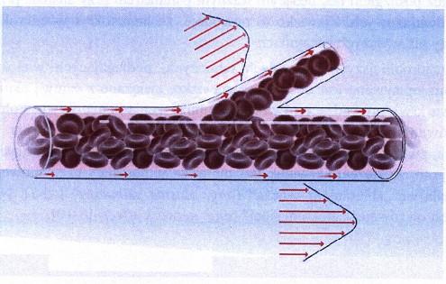 Hemoreologia Lepkość efektywna krwi Zjawisko zbierania osocza (sieciowy efekt Fåhraeusa) - warstwa osocza przy ścianie jest szeroka (efekt osiowej