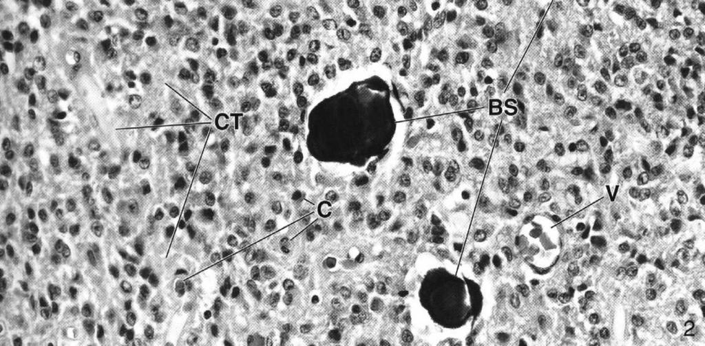 składowe zrazika: pinealocyty (komórki dokrewne) komórki
