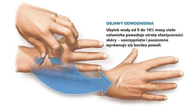 OBJAWY Objawy związane są z odwodnieniem: - Suchość skóry, - Utrata