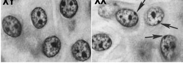 Inaktywacja chromosomu X: wyciszanie epigenetyczne Mus musculus: u samic od wczesnego etapu rozwoju zarodkowego na aktywnym chromosomie X ekspresja Tsix, na nieaktywnym ekspresja Xist John E.