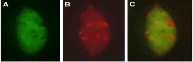 Heterochromatyna i euchromatyna tworzą obszary o różnej gęstości w jądrze komórkowym Euchromatin DAPI merge heterochromatyna centromerowa i