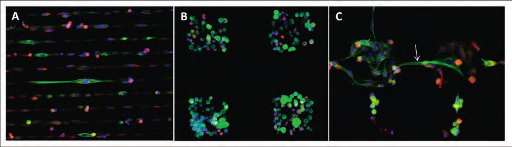 Wszechświat, t. 116, nr 1 3/2015 TYDZIEŃ MÓZGU 37 Ryc. 4. Neuralne komórki macierzyste rosnące na domenach biofunkcjonalnych o różnym kształcie (linie: A; kwadraty: B; kwadraty połączone liniami: C).