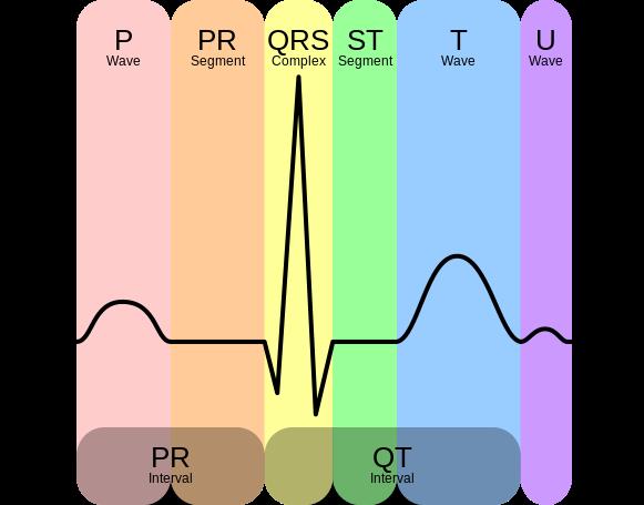 PR z przykładu odnosi się do PR interval