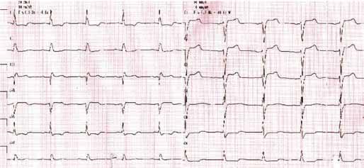 C5 C6 Rycina 3.4.