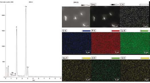 Fig. 4. EDS spectrum and maps of distribution of selected elements on the dentin surface polished with abrasive paper 4000P Rys. 4. Widmo EDS oraz mapy rozkładu wybranych pierwiastków na powierzchni zębiny szlifowanej papierem ściernym 4000P Fig.