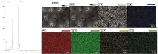 Fig. 6. EDS spectrum and maps of distribution of selected elements on the dentin surface treated with Xeno 5 self-etching adhesive system for 30 s Rys. 6. Widmo EDS oraz mapy rozkładu wybranych pierwiastków na powierzchni zębiny po 30 s aplikacji samotrawiącego systemu wiążącego Xeno 5 Table 1.