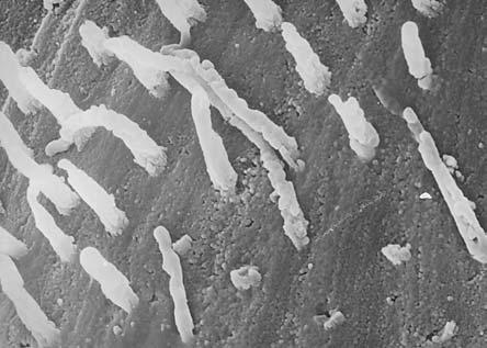 The SEM Study of Carious Cavities 165 Fig. 7. On dentine s surface plug tubules images of various lengths are visible.