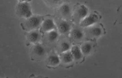 Komórki HPC-4 (rak trzustki) HPC-4 cells - Linia ustalona w 1993 (Siedlar et al.