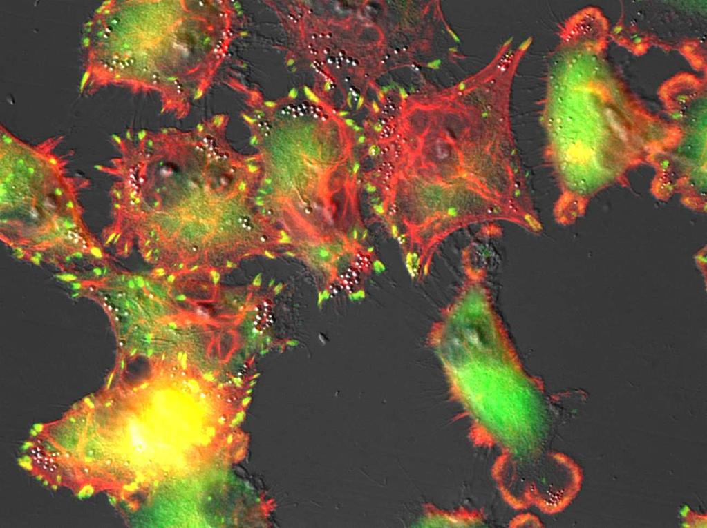 Effect of monocytes/macrophages on the morphology of