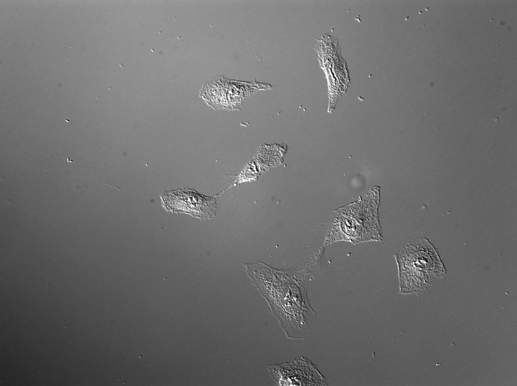 Przejście epitelialno-mezenchymalne Epithelial-Mesenchymal Transition (EMT) Radisky, D. C. J Cell Sci 2005;118:4325-4326 1.