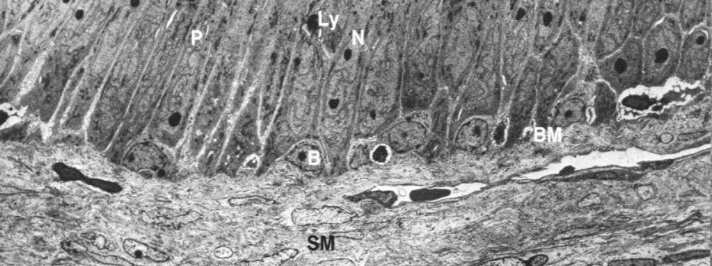 siateczka, Golgi lizosomy strefy