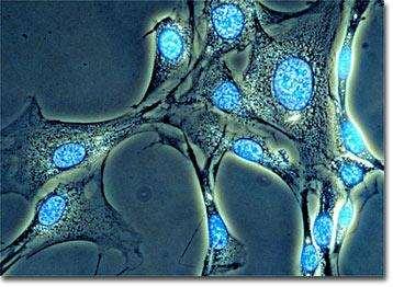 Mikroskop fluorescencyjny Niektóre substancje obecne w komórkach i tkankach mają zdolność do własnej fluorescencji: porfiryny, chlorofil, hemoglobina, witamina A.
