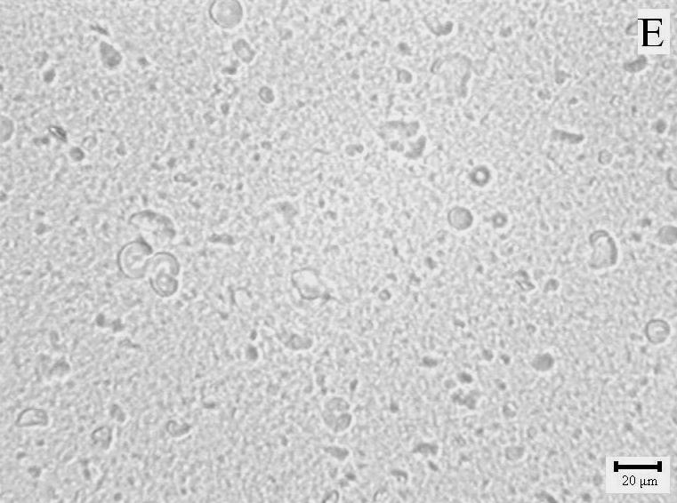 inulin gels: not homogenised (B), and obtained after homogenisation at