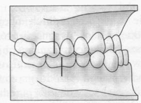 1.2. Wykonywanie aparatów ortodontycznych Umiejętność 1) rozróżnia normy zgryzu w poszczególnych okresach rozwoju człowieka, na przykład: rozróżnia normy zgryzu w poszczególnych okresach rozwoju