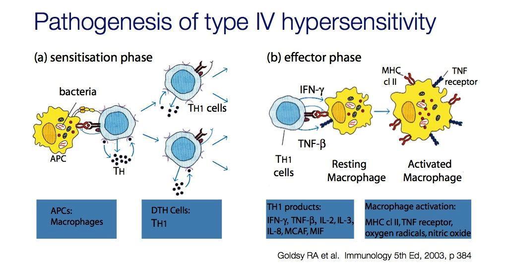 Typ IV