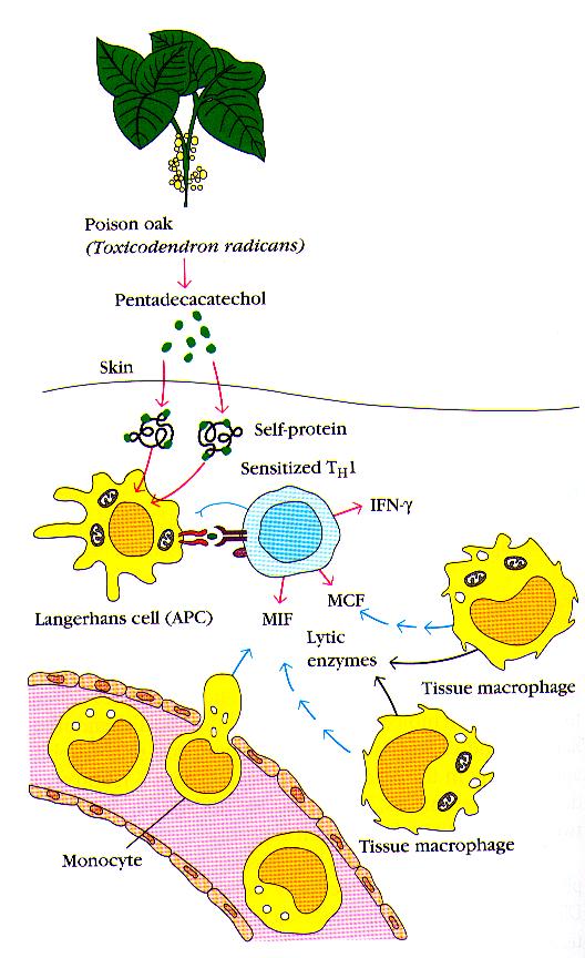 Uczulenie kontaktowe APC w skórze monocyt Własne białko Uczulony limfocyt Th1 Enzymy lityczne Makrofag w tkance Patogeny wewnątrzkomórkowe i Ag kontaktowe : -bakterie (Mycobacterium,