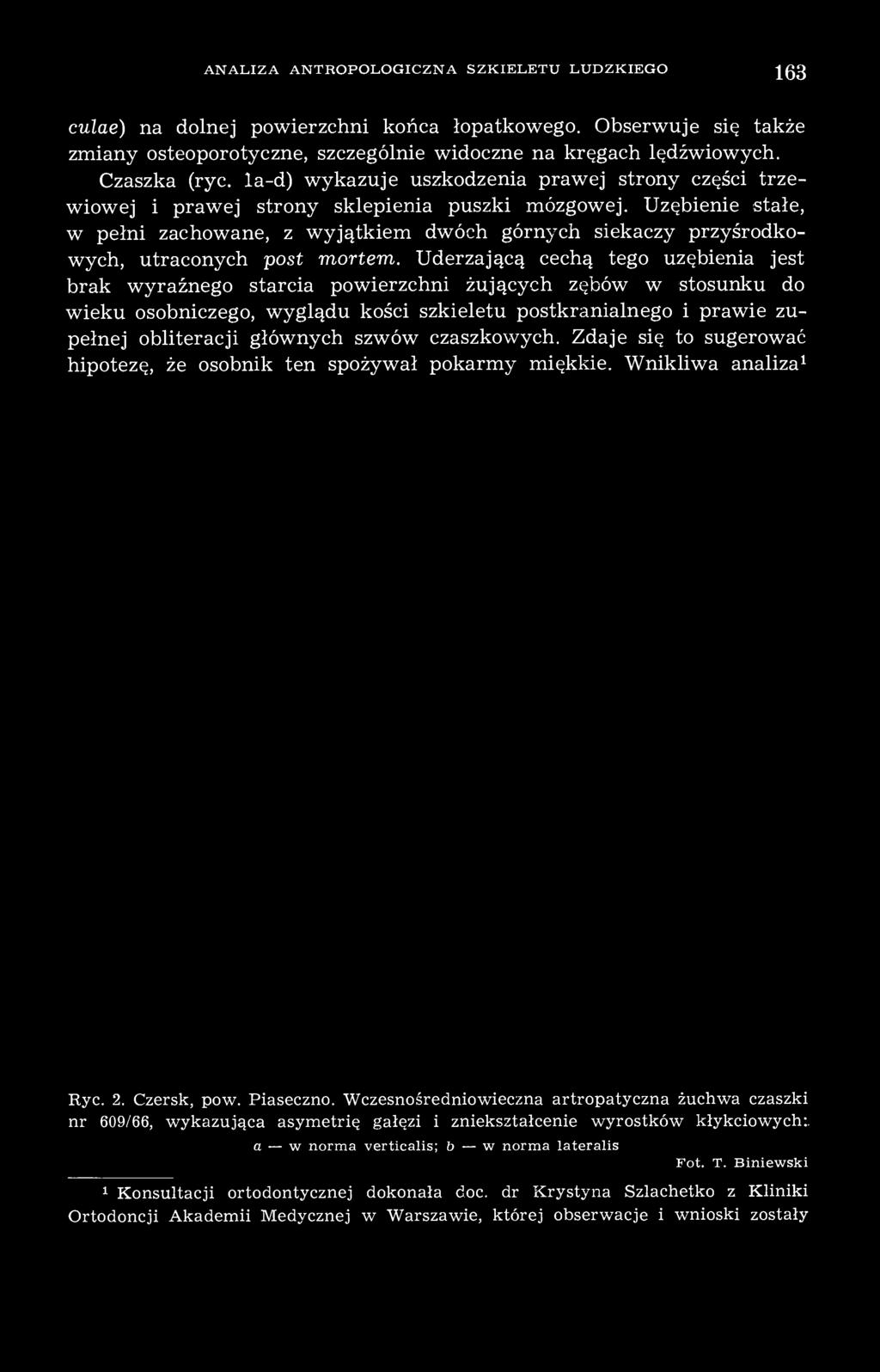 obliteracji głównych szwów czaszkowych. Zdaje się to sugerować hipotezę, że osobnik ten spożywał pokarmy miękkie. Wnikliwa analiza 1 Ryc. 2. Czersk, pow. Piaseczno.