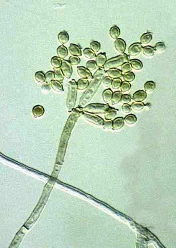 Cladosporium