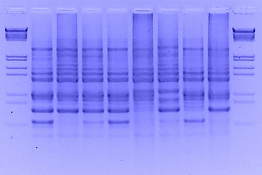 Patotyp Ss-3 Pathotype Ss-3 λ wzorzec długości DNA standard of the DNA length Rys. 1. Potwierdzenie obecności grzyba Sclerotinia sclerotiorum (Lib.