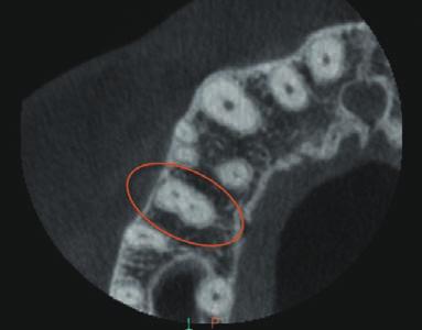 skanach CBCT): 2