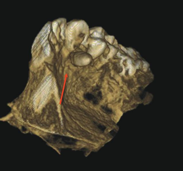 ENDODONCJA MIKROSKOPOWA.