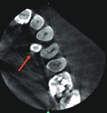 skanach CBCT): Ryc. 366.