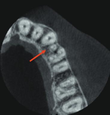 A D. CBCT jak wyżej, przekroje