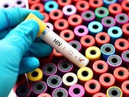 HIV/AIDS Liczba badań laboratoryjnych wykonanych w kierunku wykrycia z kolumny 1 badania z wynikiem
