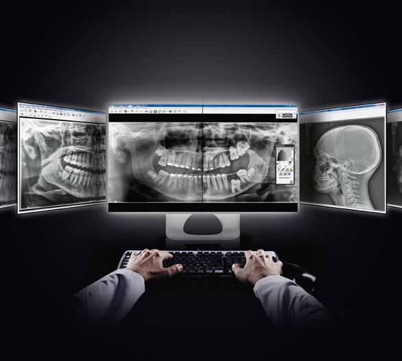 CS Adapt - nowy standard pantomografii i cefalometrii JEDYNY NA