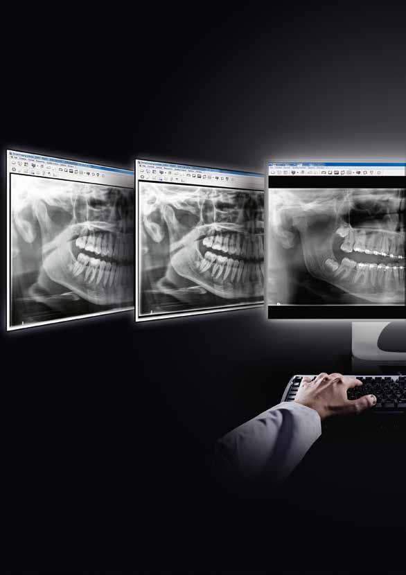 CS Adapt - nowy standard analizy obrazów diagnostycznych Adapt Kontrast Adapt T-Mat BEZ CS Adapt Aktualizacja twojego oprogramowania Carestream Dental o CS