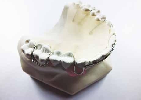 Aparat ortodontyczny z akrylu