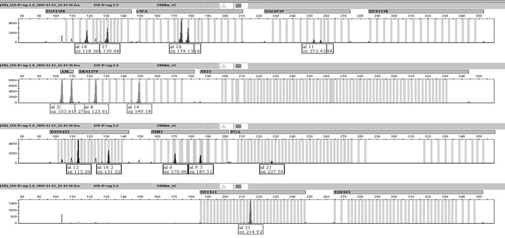 34 Ewa Kapińska i inni Nr 1 Ryc. 1B. Profi l DNA izolowanego metodą fenol-chloroform z kości odwapnianej. Fig. 1B. Profi le of DNA extracted from a decalcifi ed bone using the phenol-chloroform method.