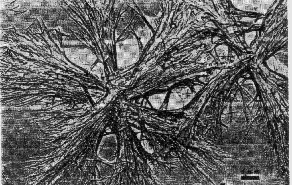 Zdjęcie mikroskopowe sferolitu dendrytycznego
