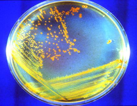 Ekstremofile Deinococcus radiodurans 5000