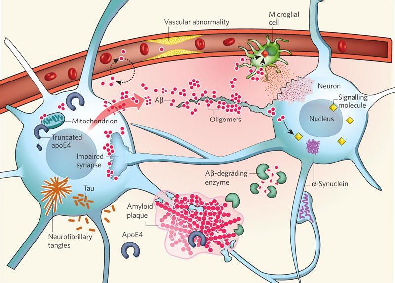 Czynnik naczyniopochodny w chorobie Alzheimera Źródła beta amyloidu w mózgu Neuron Pobudzona komórka gleju Naczynia mózgowe z rozszczelnioną barierą krew-mózg