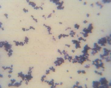 mikroskopowy bakterii